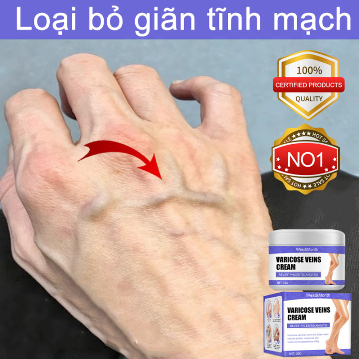 Thảo dược tự nhiên Kem giãn tĩnh mạch 30g cao hiệu quả mạnh mẽ ngăn ...