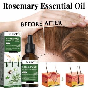 Rosemary Oil For Hair Growth Serum Rambut Gugur Serum Lebatkan Rambut Ubat Rambut Botak Hair Loss Tonic Hair Care