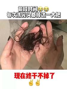 【Ready Stock】24小时内发货!电动梳子 头皮 按摩梳 生发液 红光梳 生发精华 功能 按摩梳 hair growth machine massage comb growth serum hair growth serum