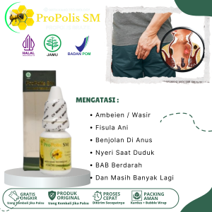 Obat Wasir Benjolan Luar Dalam Ambeien Gatal Di Lubang Anus Dubur Terasa Perih Panas BAB Berdarah Sakit Saat Duduk Fisula Ani Dengan ProPolis SM