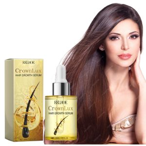 Ginseng Anti-Hair Loss Nourishing Essence for All Seasons Suitable for Hair Care Seekers Men and Women Nourishes and Thickens Hair Prevents Hair Loss