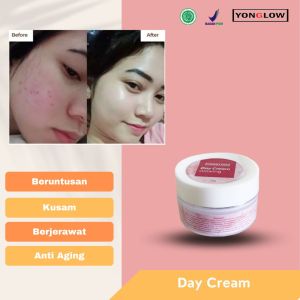 Day Cream Krim Siang Yonglow Skincare Resmi BPOM Formulasi dr Yong Pemutih Kulit Wajah Penghilang Beruntusan Bekas Jerawat Wajah Pembersih Muka Ampuh