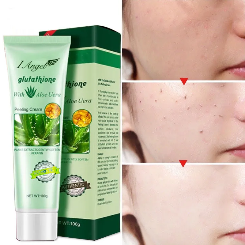 glutathione with aloe vera peeling cream fake vs real I Angel Magic Exfoliate 100g Beauty Supplements