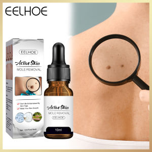 【Hot Sale】Eelhoe Aclive Skin Mole Removal Mole And Skin Tag Remover Liquid Genital Wart Papillomas Removal Of Warts Skin Tags Removing Against Moles Skin Tag Removal Solution Painless Mole Skin Dark Spot Removal Face Wart Tag Removal Removal Cream
