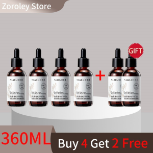 SG Stock [Fast Effective] Hair Growth Serum Ginger Hair Tonic 30ML Hair Growth For Men And Women Anti Hair Loss Preventi