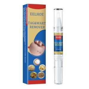 【🔥Ready Stock】Wart Remover Ointment 20g Warts Removal Cream Ubat Buang Ketuat Kutil Removal 除疣软膏 克疣膏