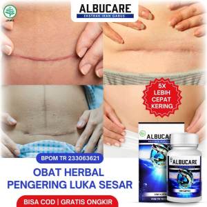 ALBUCARE 100% Ekstrak Ikan Gabus - Obat Luka Sesar - Pengering Luka Operasi Sesar Asli - Pasca Operasi Sesar - Cepat Sembuhkan Luka | Hallal Sudah Bpom