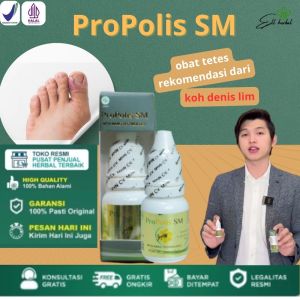 Propolis SM - Obat Tetes Kuku Cantengan Infeksi Jamur Kuku Jempol Kaki Bau Koreng Di Kaki Kuku Bernanah ASLI 100%