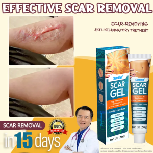 15 days Scar removal gel Scar remover for old scar on leg Repair Skin Care Stretch marks Scars remover for old scars Burn Scar Remover for Body And Face Scar Gel Acne Scar Treatment Skin Care cream 30g