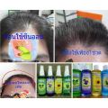 #หัวสเปรย์ 1 ขวด SUNON Hair Tonic ซันออน แฮร์โทนิค 100 ml. SUN ON บำรุงเส้นผม แก้คัน ลดรังแค เร่งผมยาว บำรุงรากผม ให้แข็งแรง เร่งผมยาว ลดคัน. 