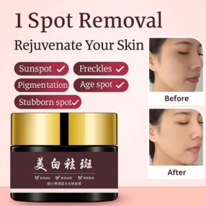 Whitening Spot Cream Anti-Aging Wrinkle Fast Brightening Remove Melasma and Age Spots Improve Skin Elasticity Face Care