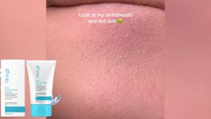 【Mild Exfoliating Scrub】Deep Pore Cleansing + Hydrating Nourishment Gentle for Sensitive Skin Smooth & Soften Skin Natural Ingredients Non-Irritating Formula