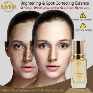 RAVINIA Whitening Freckle Removing Essence 50ml Dispel Freckle Brighten Dull Skin Lighten Marks