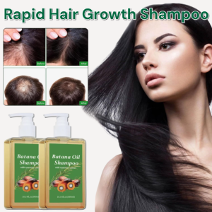 Hair Growth Shampoo Anti Hair Loss Shampoo Oil Control Anti-Dandruff Shampoo Scalp Treatment