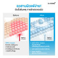 Dr.PONG CalmMEA 1.5 soothing cream มอยส์เจอร์ไรเซอร์ บำรุงผิวชุ่มชื้น ลดผิวอักเสบ แดงคัน เซ็บเดิร์ม ขนาดคุ้ม 50 กรัม ใช้ได้นาน. 