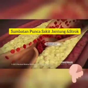 Yikang Health Care TASLY Dan Shen Plus (30 Caps) (New Stocks)100 Original - FREE SHIPPING