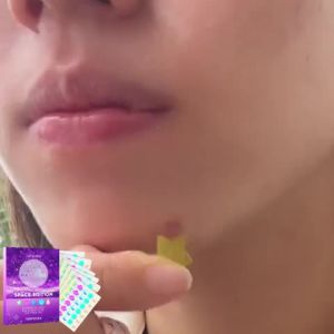 Jaysuing Acne Patch - Reduces Facial Acne and Pimples Cares for Closed Comedones Balances Skin and Refines Pores