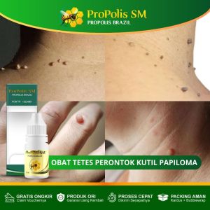 Obat Untuk Kutil-Obat Tetes Hancurkan Kutil-Daging Jadi-Penghilang Keloid-Obat Hilangkan Kutil Papiloma-Perontok Papiloma-Penghancur Skin Tag-Kutil Dileher-Punggung-Tangan-Propolis SM 100% ASLI