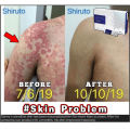 【Buy 2 free 1】 Shiruto BElixz Vitamin for Immute System Immune Vitamin Japan Original 100 Quality Guarantee shiruto Supplement 1 CoreNutri Market. 
