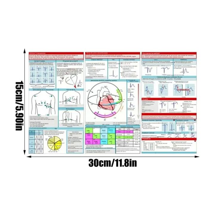 Ecg Interpretation Pocket Card Horizontal & Vertical Layout Compact ...