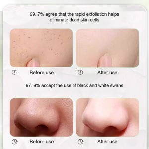 Exfoliating Gel TK Popular Facial Exfoliating Gel For Face Deep Clean Gentle Peeling/Facial Exfoliating Gel For All Skin Types/Removes Dead Skin