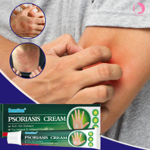 Sumifun psoriasis treatment cream 20g gamot sa kati kati sa balat Natural herbal formula eczema treatment cream for itchy skin and anti fungal cream ointment for psoriasis treatment cream