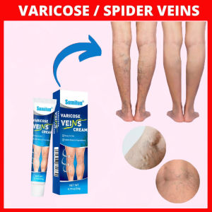 Varicose Veins Cold compress Remover Cream Relieves heaviness swelling for Varicocele Spider Vein