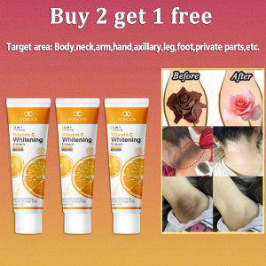Vitamin C Whitening Cream Armpit Whitening Cream Private Part Whitening 50g Body Armpit Whitening Cream For Hard-To-Whiten Skin Areas Removes Dark Skin On Armpits Private Parts Elbows And Knees