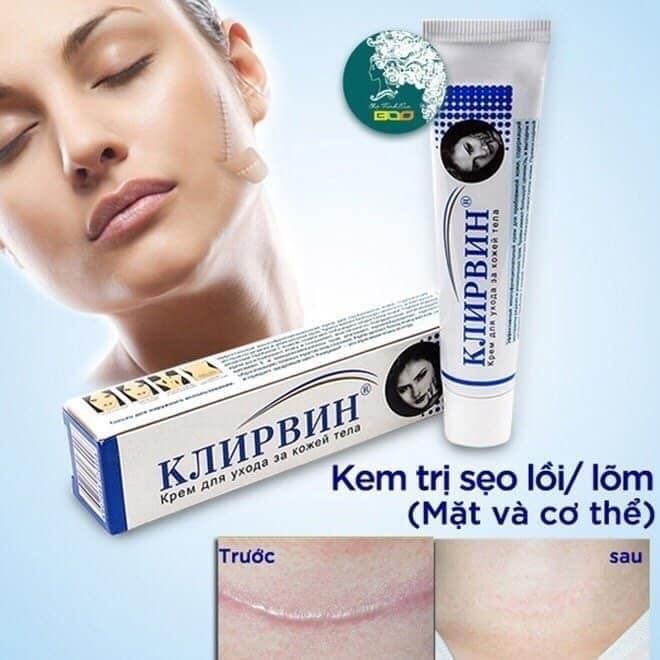 Kem trị sẹo thâm mụn 25g kem trị sẹo lồi, sẹo lõm hiệu quả - TKVT1