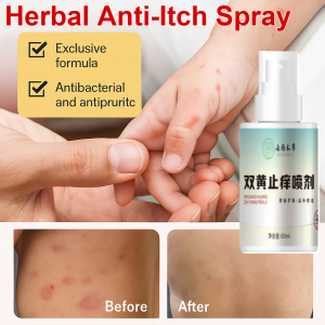 Herbal Itch Relief Topical Spray