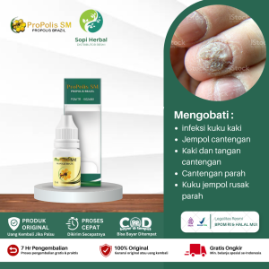 infeksi kuku kaki Jamur Kuku pengobatan cantengan Mempromosikan Kuku Tumbuh Perawatan Kuku Sehat Perawatan Kaki - Propolis SM