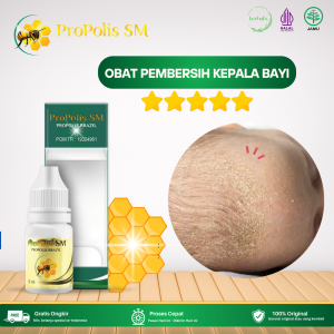 Obat Pembersih Kepala Bayi Obat Cair Penghilang Kerak Kepala Bayi Obat Pembersih Kili Kili Kepala Obat Kulit Kepela Berkerak Obat Kurap Dermatitis Obat Ruam Merah Di Kepala Gatal Dengan Propolis SM