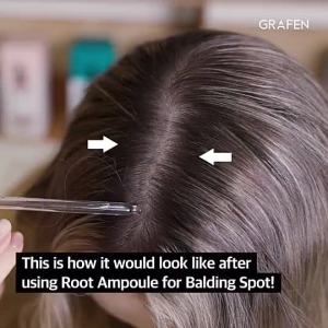 MY[GRAFEN]RootBoosterScalpEnhancingAmpoule50ml[Anti-HairLossHouttuyniacordata100000ppm10typesofNaturalHerbalExtract]