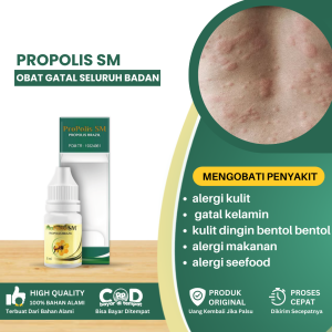 Obat Gatal Seluruh Badan Obat Alergi Gatal Kulit Obat Gatal Kelamin Obat Alergi Kulit Dingin Bentol Bentol Obat Alergi Makanan Obat Gatal Biduran - Propolis SM