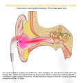 LASTEK Otitis Media Tinnitus Deafness Laser Treatment Hearing loss Improve Blood Circulation Laser with ear canal probe. 