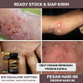 Proskin - Obat Cenang Bernanah, Obat Benjolan Bernanah, Obat Gatal Bernanah, Obat Gudik Bernanah, Obat Luka Borok Bernanah, Obat Budug Bernanah, Obat Borok Bernanah, Salep Buat Koreng, Benjolan Nanah Di Jari Jari Tangan. 