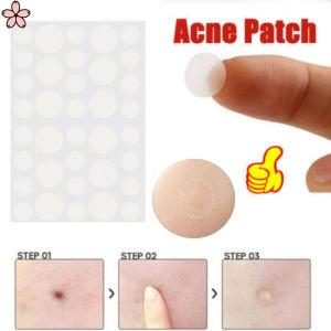 Waterproof Acne Patch Blemish Treatment Skin Care Acne Repair Oxy Acne Pimple Clear Fit Master Acne Patch [Pretty Sakura]