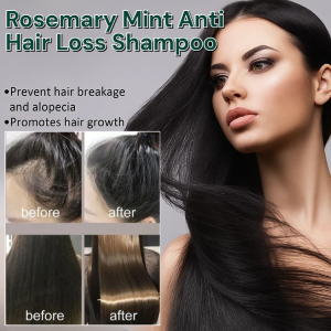 Rosemary Mint Anti Hair Loss Shampoo Hair Growth Shampoo For Women Men