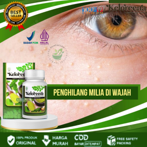 Masker Menghilangkan Milia Di Wajah Masker Wajah Penghilang Milia Obat Bintik Bintik Di Bawah Mata Hilangkan Bruntusan Kelopak Mata Atas Bawah Bruntusan Milia di Hidung Beruntusan di Wajah Jerawat7 Syringoma Xanthelasma Atasi Dengan Keloreena