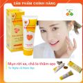 Kem Nghệ Thái Dương Nano Bạc Tuýp 20g - Kem Nghệ Ngừa Mụn Trứng cá, Giúp Mau Liền Sẹo và Làm Mỡ Vết Thâm Nám. 