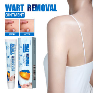 EELHOE Wart removal cream cleanses the skin repairs and cares for the body and face removes facial labels and Keyu cream