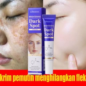 Kem Điều nhang nám đốm đen đổi màu da nám da và kem loại bỏ nhang