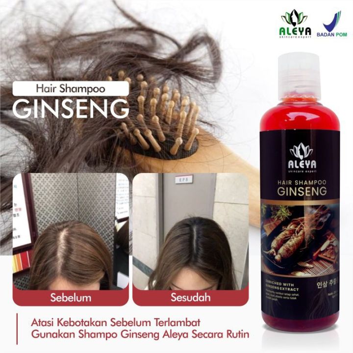 Sampo%20Penumbuh%20Rambut%20Cepat%20Panjang%20Gingseng%20Obat%20Rambut%20Rontok%20Parah%20Botak%20Ketombe%20-%20Image%202