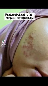 SERUM RETINOL SR12 SERUM BIKIN MUKA MULUS SERUM BAGUS PORI² TIDAK TERLIHAT SERUM MENCERAHKAN KULIT WAJAH