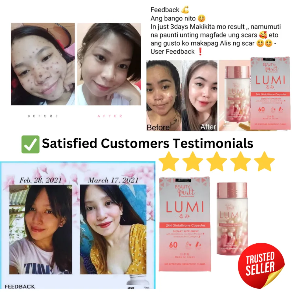 lumi glutathione review before and after Liposomal Glutathione Supplement - 600mg Per Day main image 1