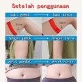 [1 BOX ISI 10 PCS] Koyo Pelangsing Slim Patch Pembakar Lemak Obat Pelangsing Badan Stiker Pusar Obat Herbal Alami Patch Pelangsing Detox Penurunan Berat. 