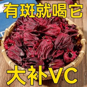 【Anmi Food】Ribena Natural Dried Roselle Flower Herbal Tea 洛神花/玫瑰茄 Health Tea