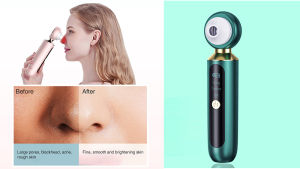 Visual Blackhead Remover Pore Cleaner Black Head Suction Extractor Tool Kit Acne Removal Vacuum Tool