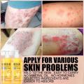 Sumifun Beauty Eczema Body Wash 500ml / Sabun Eksim / Sabun Gatal Kulit Ampuh / Sabun Jerawat Punggung / Sabun Mandi Cair. 