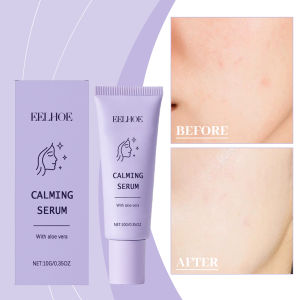 EELHOE Soothing Roller Essence Nourishes tightens brightens locks in moisture relieves dryness and Soothing Essence Calming Serum
